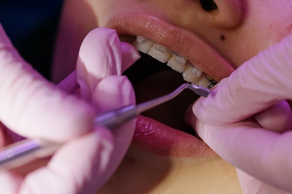 Que faire en cas d’urgence dentaire ?